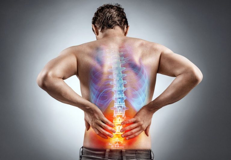 complete back pain diagram