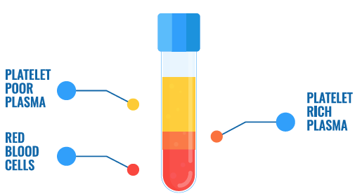 Platelet Poor Plasma