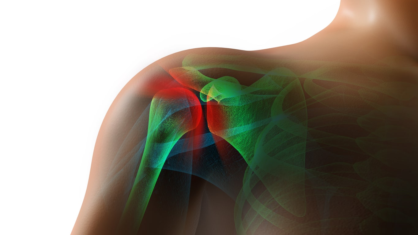 tearing rotator cuff